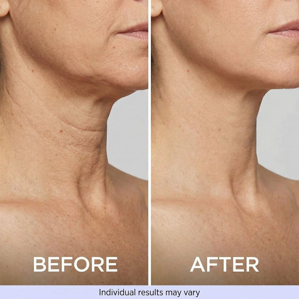 5. What Actually Happens to Your Neck Over 8 Weeks