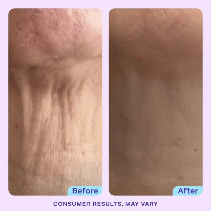 DermaPress™ Neck Firming Cream