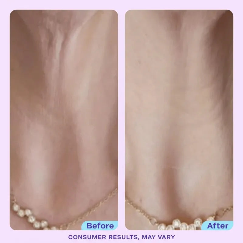 DermaPress™ Neck Firming Cream