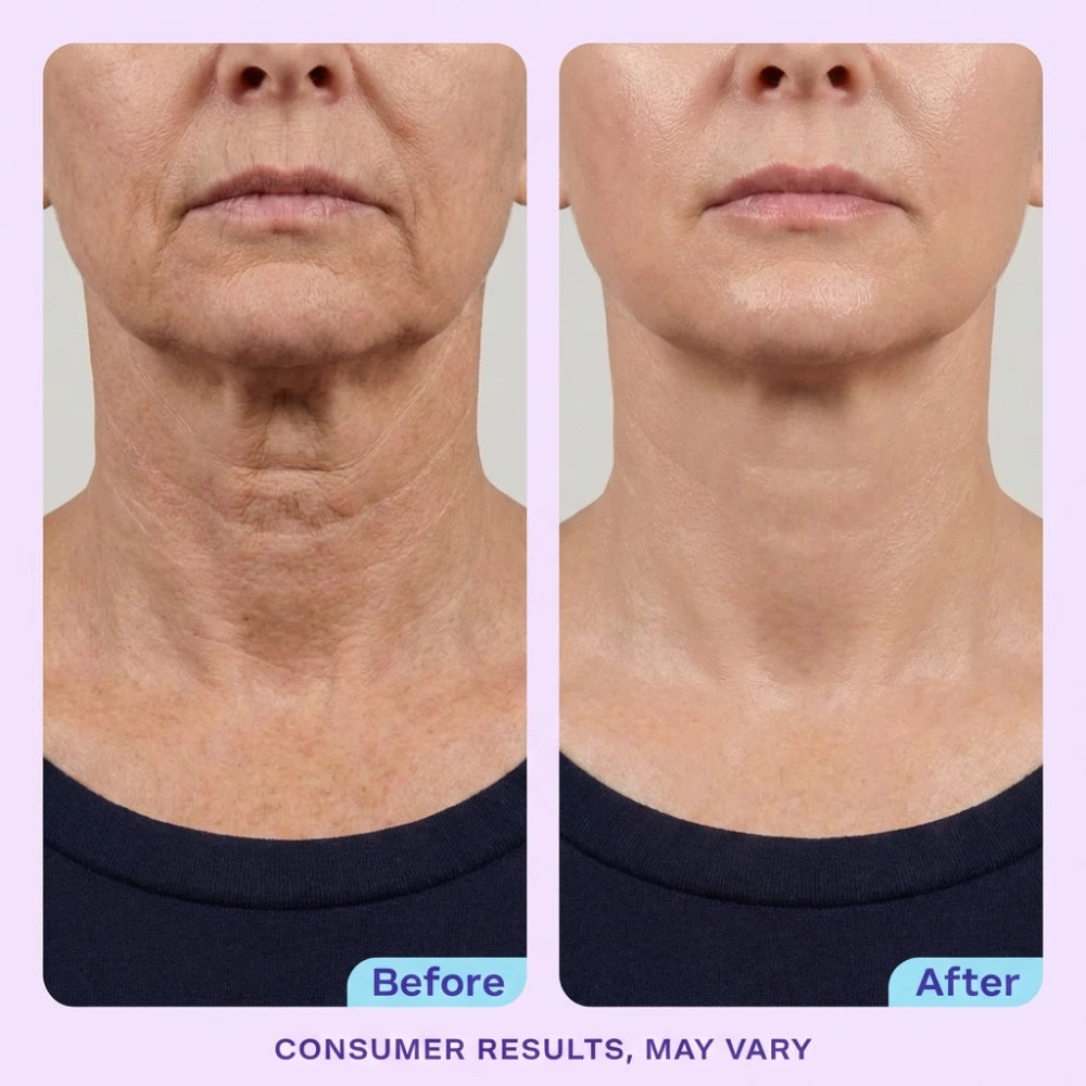 DermaPress™ Neck Firming Cream