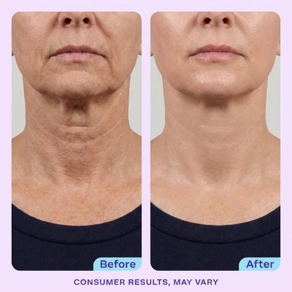 DermaPress™ Neck Firming Cream